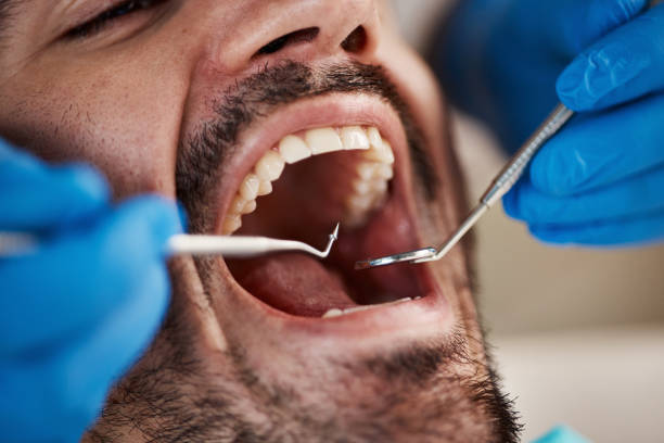 Best After-Hours Emergency Dentist in Marfa, TX